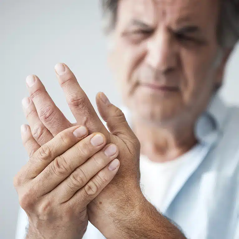 hand ligament injury, Dupuytren's Contracture Treatment