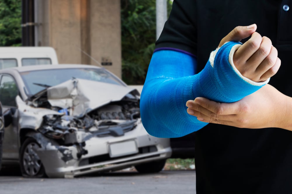 Hand / Arm Accident Doctor - Motor Vehicle Injuries Fairfax VA