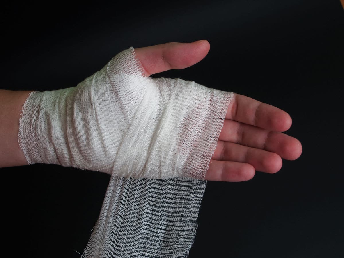 common hand injuries - orthopedic surgeon fairfax va