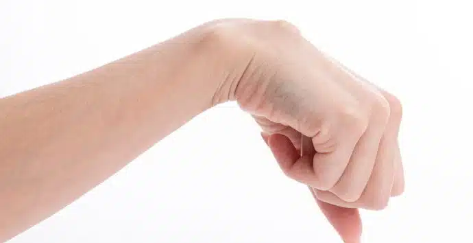 ganglion cysts masses treatment fairfax va