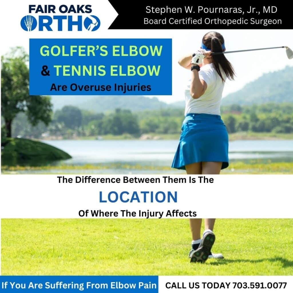 What Is the Difference Between Golfers Elbow and Tennis elbow?