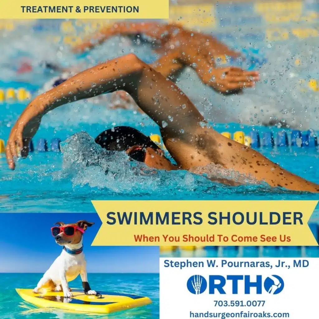 FAIRFAX Swimmers Shoulder Specialists. Contact Leading Orthopedic Surgeon Dr. Stephen Pournaras for Shoulder Impingement Syndrome (SIS) treatments Today!